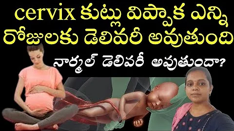 cervix stitches removed after normal delivery in telugu