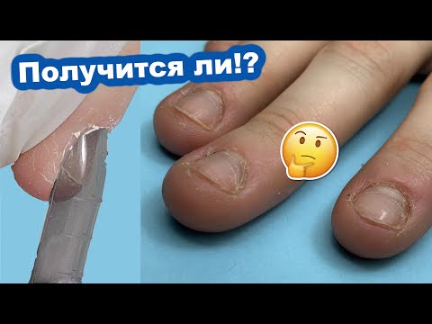 Верхние Формы для ОБКУСАННЫХ Ногтей - Получится ли!? Преображение ногтей - Маникюр и Наращивание