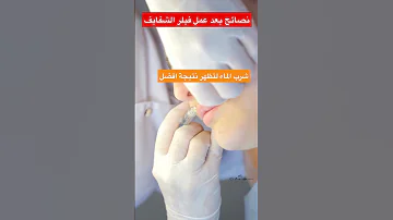 نصائح بعد عمل فيلر الشفايف 