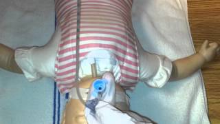 Neonatal Suction CBO (Open & Closed)