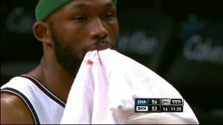 Reggie Evans Gets Tooth Knocked Out, Stays In Game