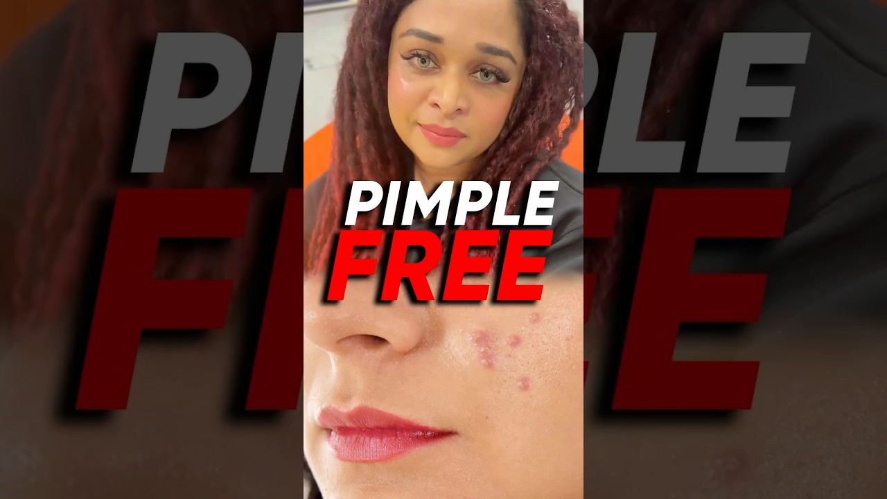 പിമ്പ്ൾസ് ഉള്ളവർ ഇത് ഉപയോഗിച്ച് നോക്കൂ | Pimple Patches | Explore Beauty With Ash 