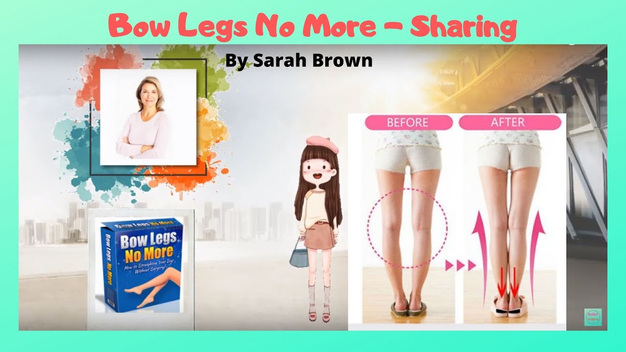 ✅ BOW LEGS NO MORE REVIEW BY SARAH BROWN SUFFERED FOR 26 YEARS