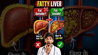 Fatty Liver: Fat Inside!#FattyLiver #LiverHealth #FattyLiverDisease #NAFLD #PharmacistAbhishek