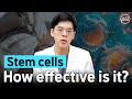 Why Stem Cell Procedures Are Becoming Popular Worldwide | AB Plastic Surgery