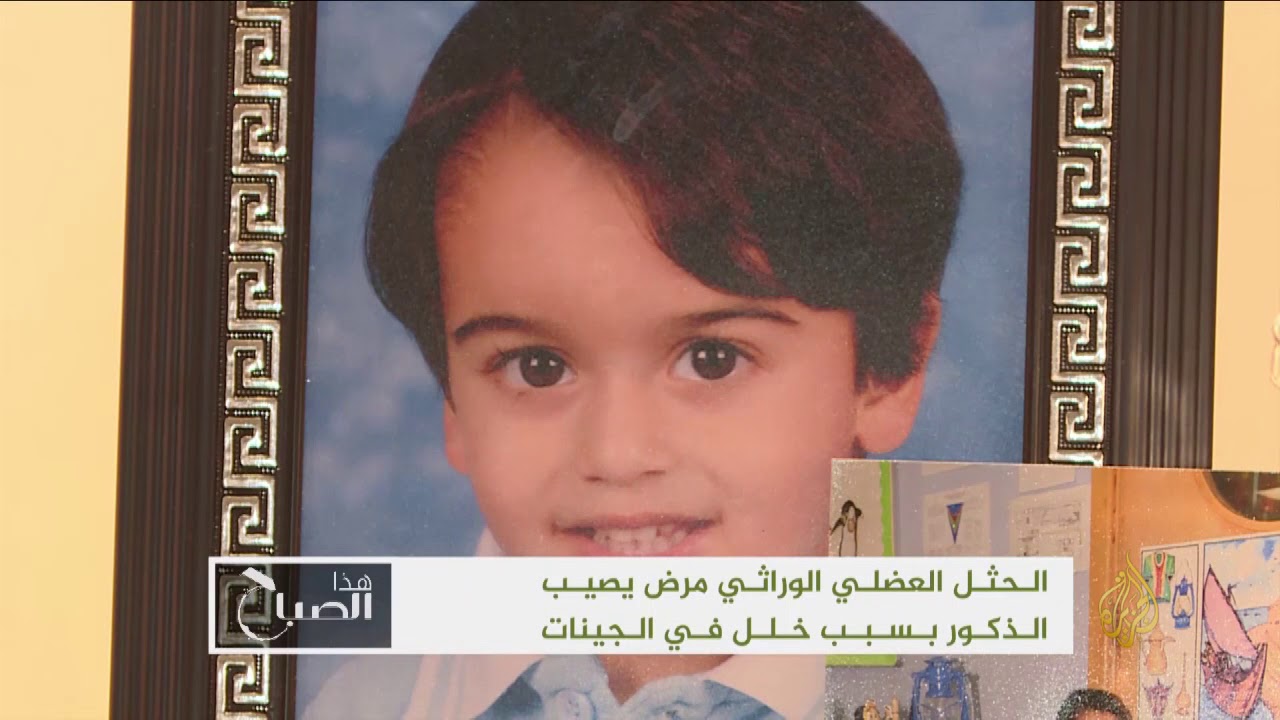 هذا الصباح- الحثل العضلي الوراثي