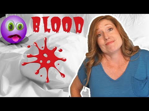 The EASIEST Way to Get Blood Out of Sheets