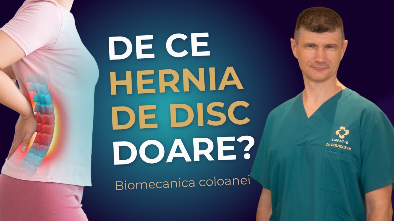 Biomecanica coloanei. Cum doare hernia?