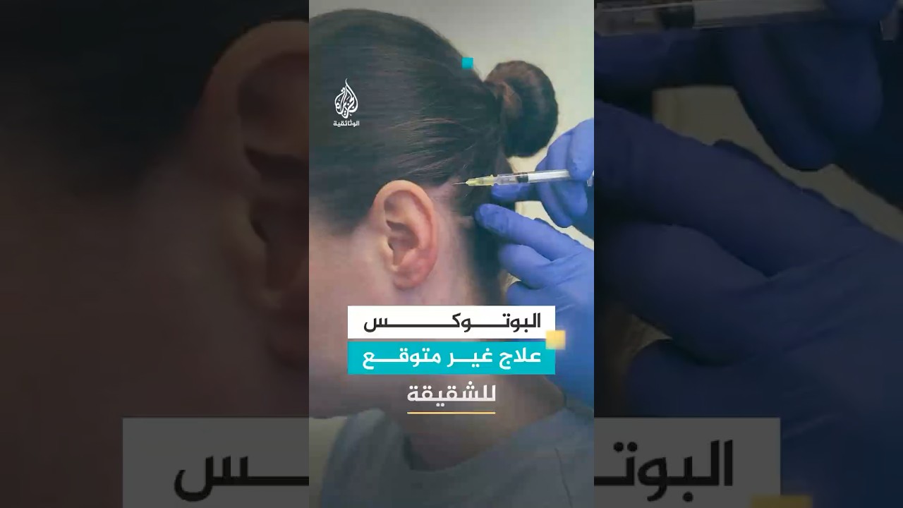 منذ سن السادسة وهي تعاني من الصداع النصفي.. امرأة تجد علاجها في البوتوكس