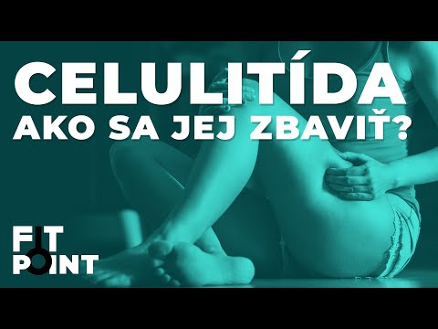 Video: Je periorbitálna celulitída núdzová situácia?