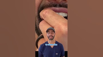 Invisalign cleaning technique that works best for me.