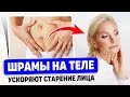 Шрамы на теле меняют овал и старят!