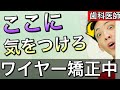 【ワイヤー矯正を成功させるために】あなたが気をつけるべきポイント