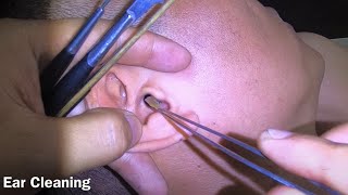 耳掃除 귀 청소 Ear Cleaning #308