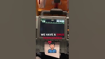 CAUSES of Sinus Tachycardia