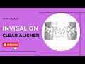 Invisalign clear aligner | Digital Planning