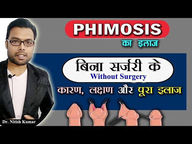 Phimosis Treatment With/Without Surgery in Delhi, India