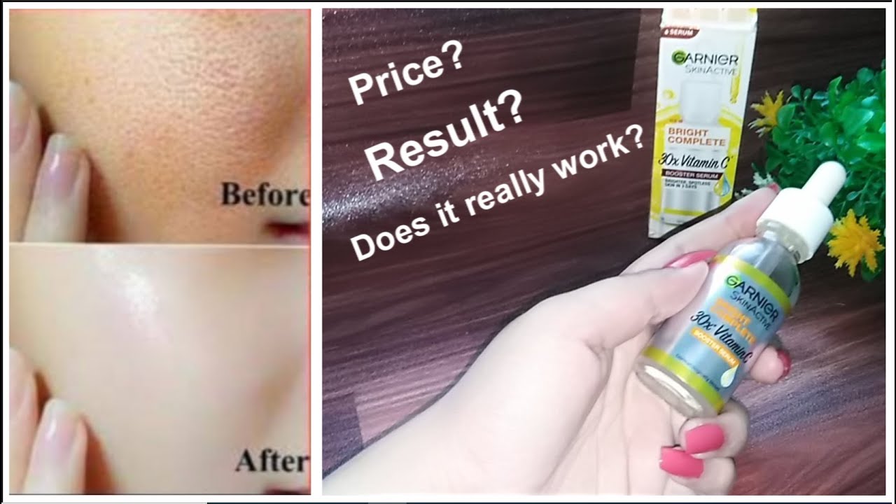 Garnier Vitamin C Serum Review Vitamin C serum kaise use karein YouTube