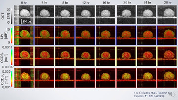 Spheroid dynamics imaging by El-Sadek Univ. Tsukuba (OPJ2020)