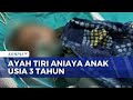 Balita 3 Tahun di Solok Dianiaya Ayah Tiri, Dirawat Intensif di Rumah Sakit | KOMPAS SIANG
