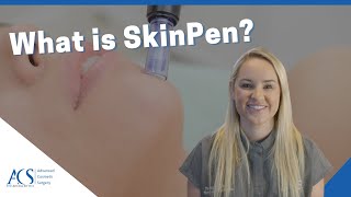 The SkinPen Treatment: Is it Microneedling? Benefits, Treatment Areas, Cost and More!