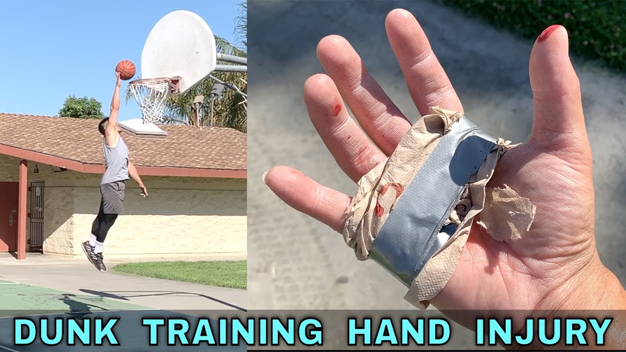 DUNK TRAINING HAND INJURY Training Vlog (81320) YouTube