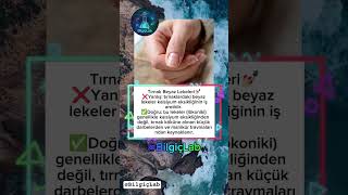 Yanlış bildiğimiz tırnak lekeleri gerçeği! Sebebi kalsiyum değil, minik darbeler. 🔨❌