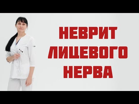 Невропатия (неврит) лицевого нерва.  Паралич Белла