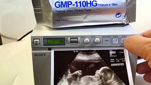 How to clean the printer head for ultrasound thermal video printer 01