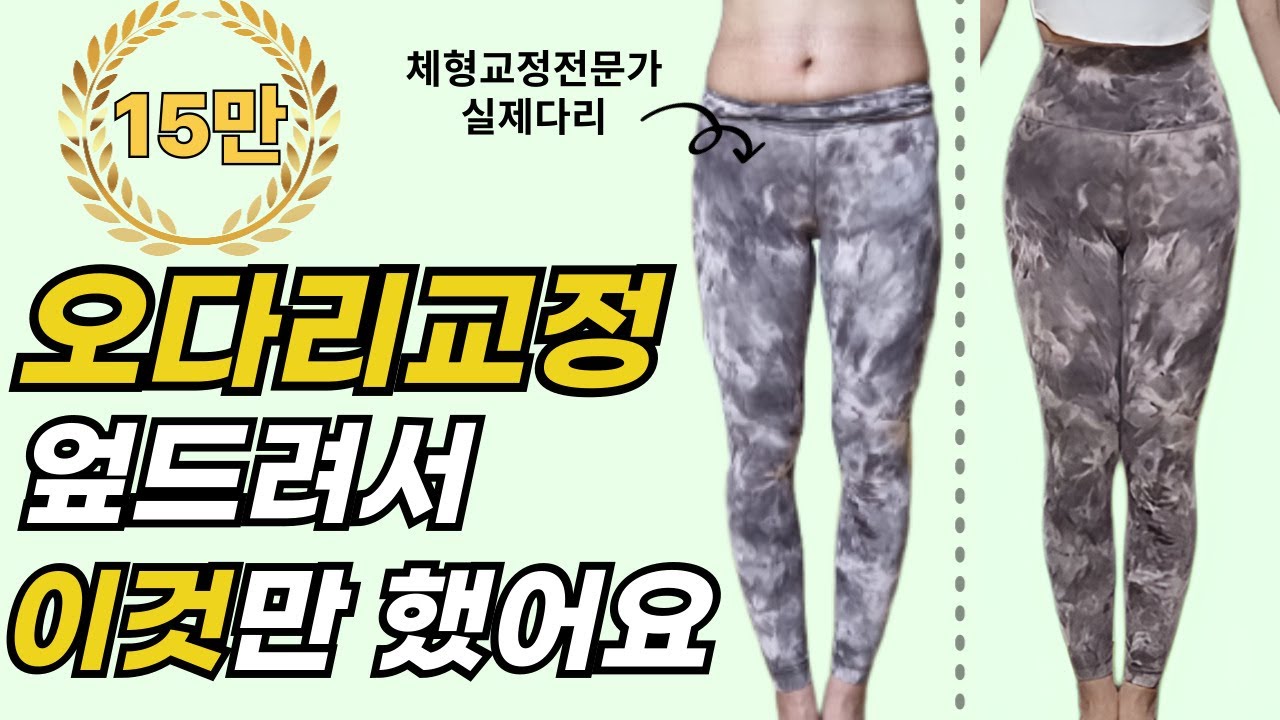 오다리교정운동 딱 2주만 따라해보세요. 무릎통증없이 휜다리를 일자다리로 만드는 방법!
