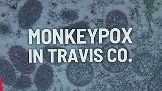 APH investigating possible monkeypox case in Travis County