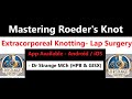 Vid 2.1 - Roeder's Knot: Master Extracorporeal Knotting in Lap Sx. (UHD) #Roeder @zoltangyurika6890