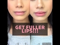 How to get FULLER LIPS naturally! | Malvika Sitlani