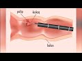 Kolonoskopi nedir? - Prof. Dr. Alper Yurci (Gastroenteroloji Uz.)