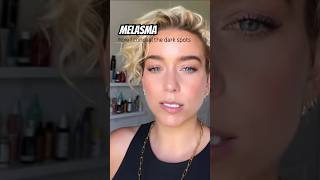 Exclusive How to conceal melasma #makeuptutorial #concealer #melasma #hyperpigmentation Profile