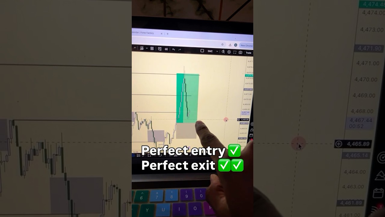 If you want to learn trading, subscribe this channel 