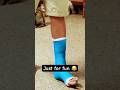 Accident scene’s #viral #trending