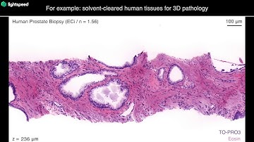 OTLS technology overview