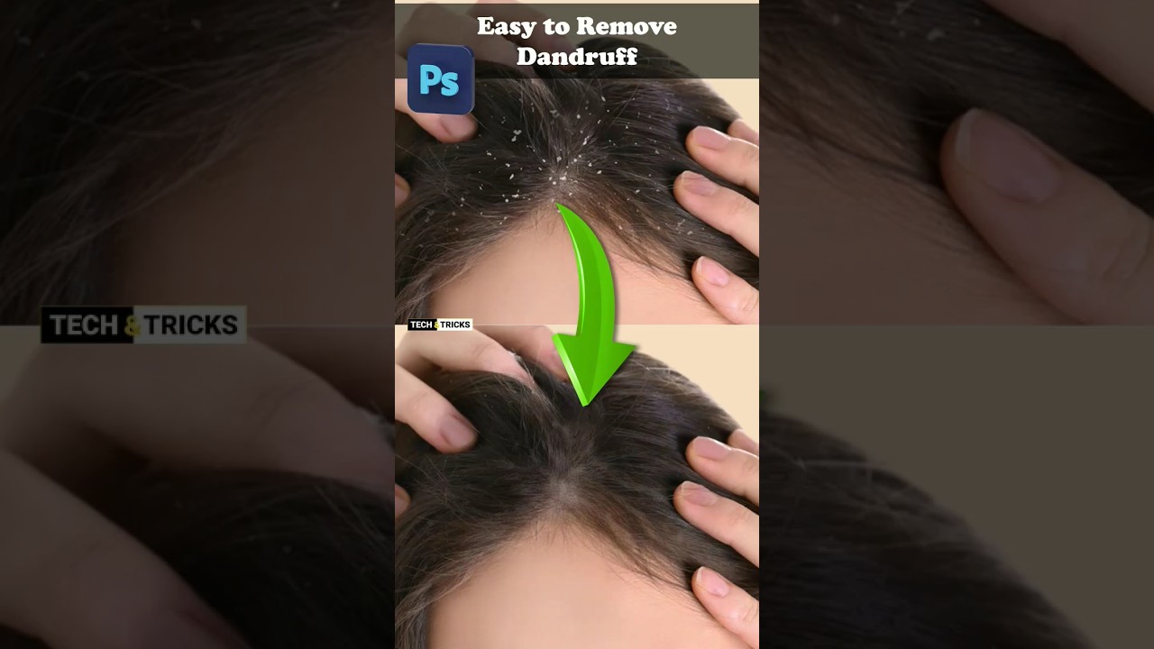 How to remove Dandruff in Photoshop 