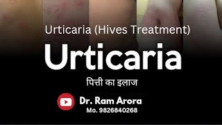 Urticaria Treatment / Hives Treatment / पित्ती का इलाज / Skin Problem Treatment / Through Ayurveda