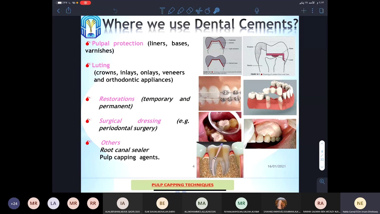 Dental Cement YouTube