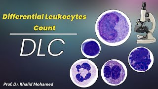 Differential leukocytes count, DLC. العد النوعي لخلايا الدم البيضاء