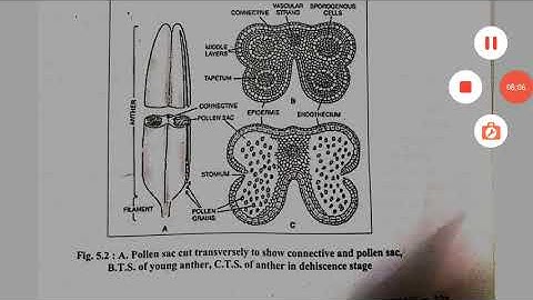 S.Y.Bsc Practical-Tetrasporangiate Anther & Types of Ovules...Part-1
