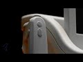Ultherapy - Hyper Personal Lift