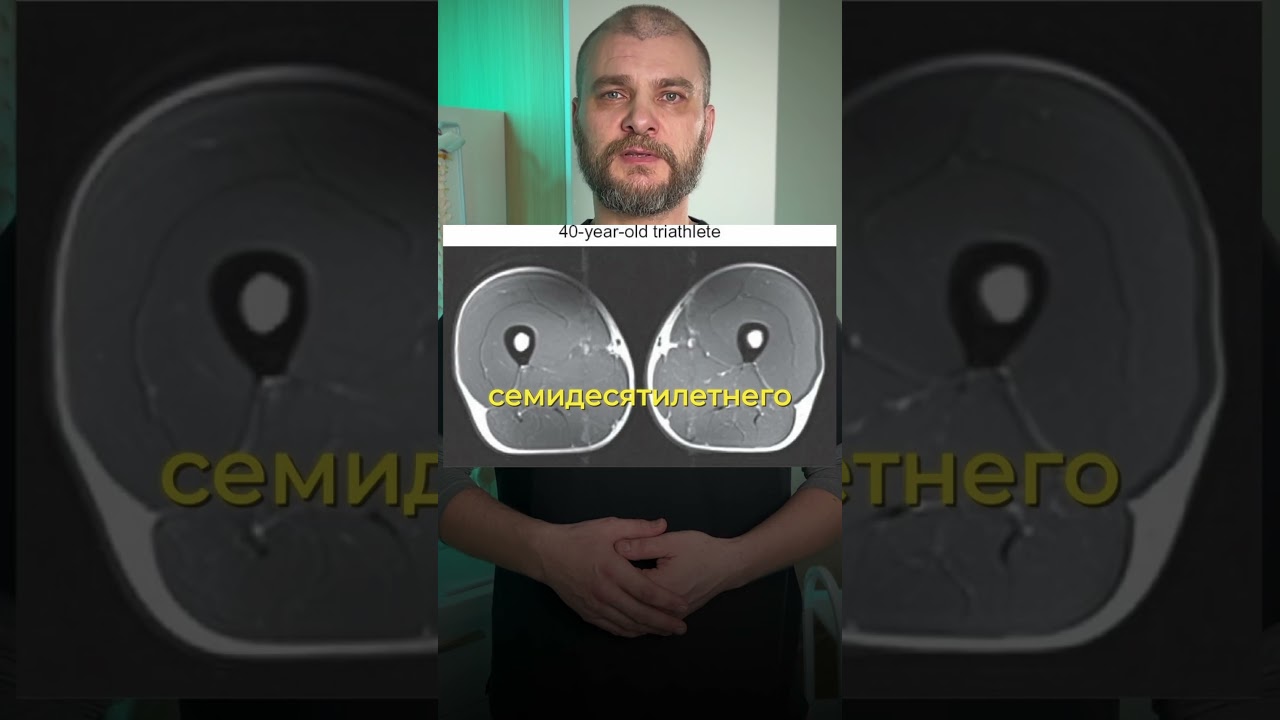 Секреты молодости: Как триатлеты сохраняют мышцы в 70 лет и замедляют старение