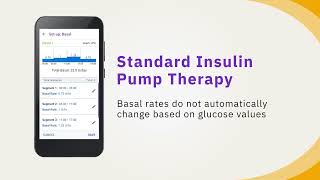 Omnipod® 5: Understanding Insulin Pump Therapy