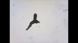 Amoeba proteus migration timelapse