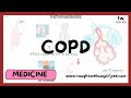 COPD Explained: Understanding the Causes, Symptoms, and Treatment