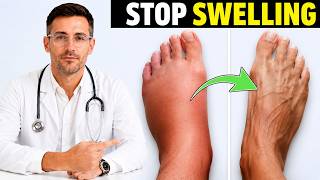 Swollen Feet? Poor Leg Circulation? 3 Fast Exercises That Help + 1 Simple Test