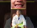 😁 பிள்ளைக்கு பல் வலி இருக்கா? Milk Teeth Care பற்றி தெரிஞ்சுக்கோ | Dental Tips